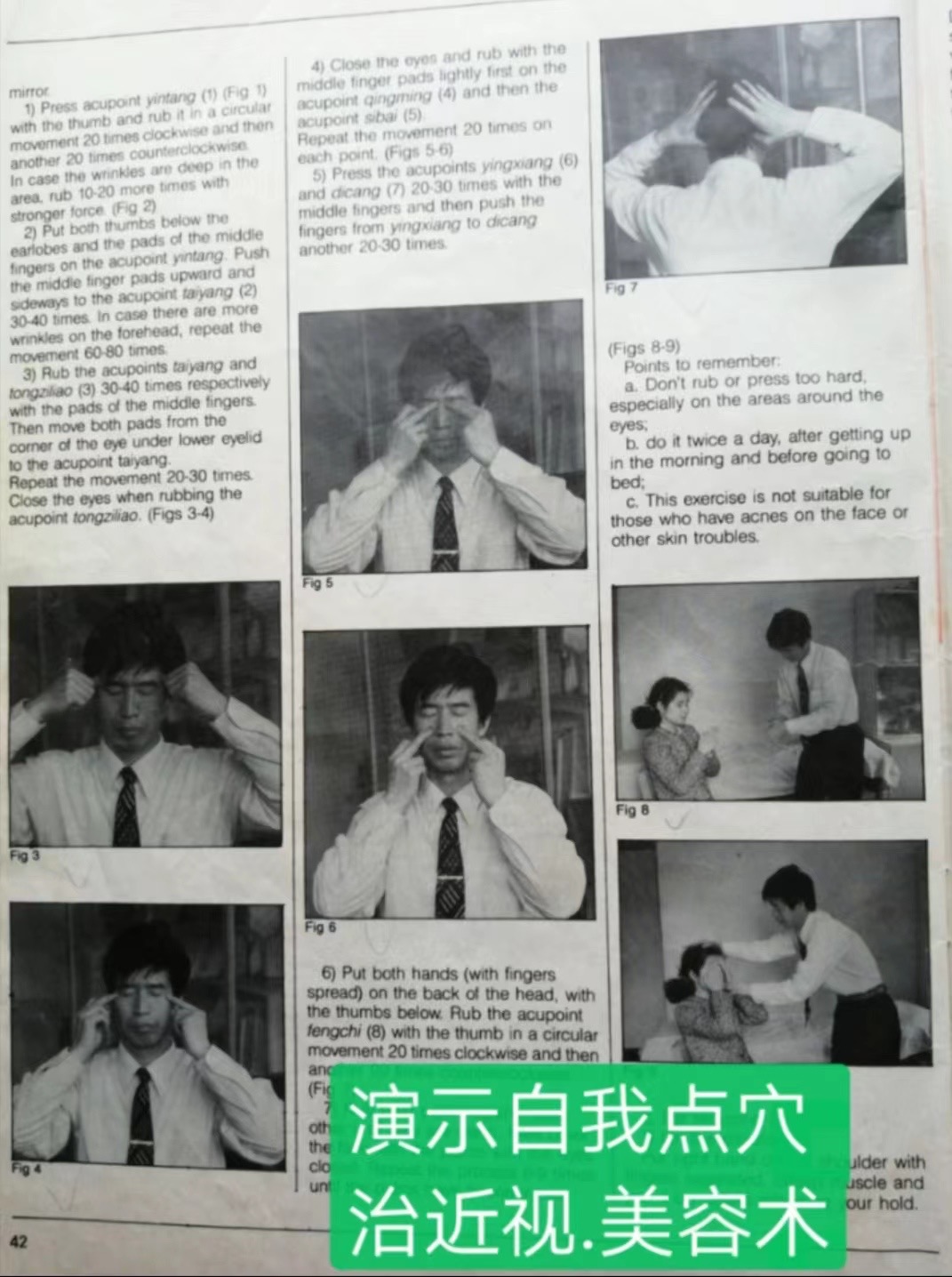 点穴治近视图片