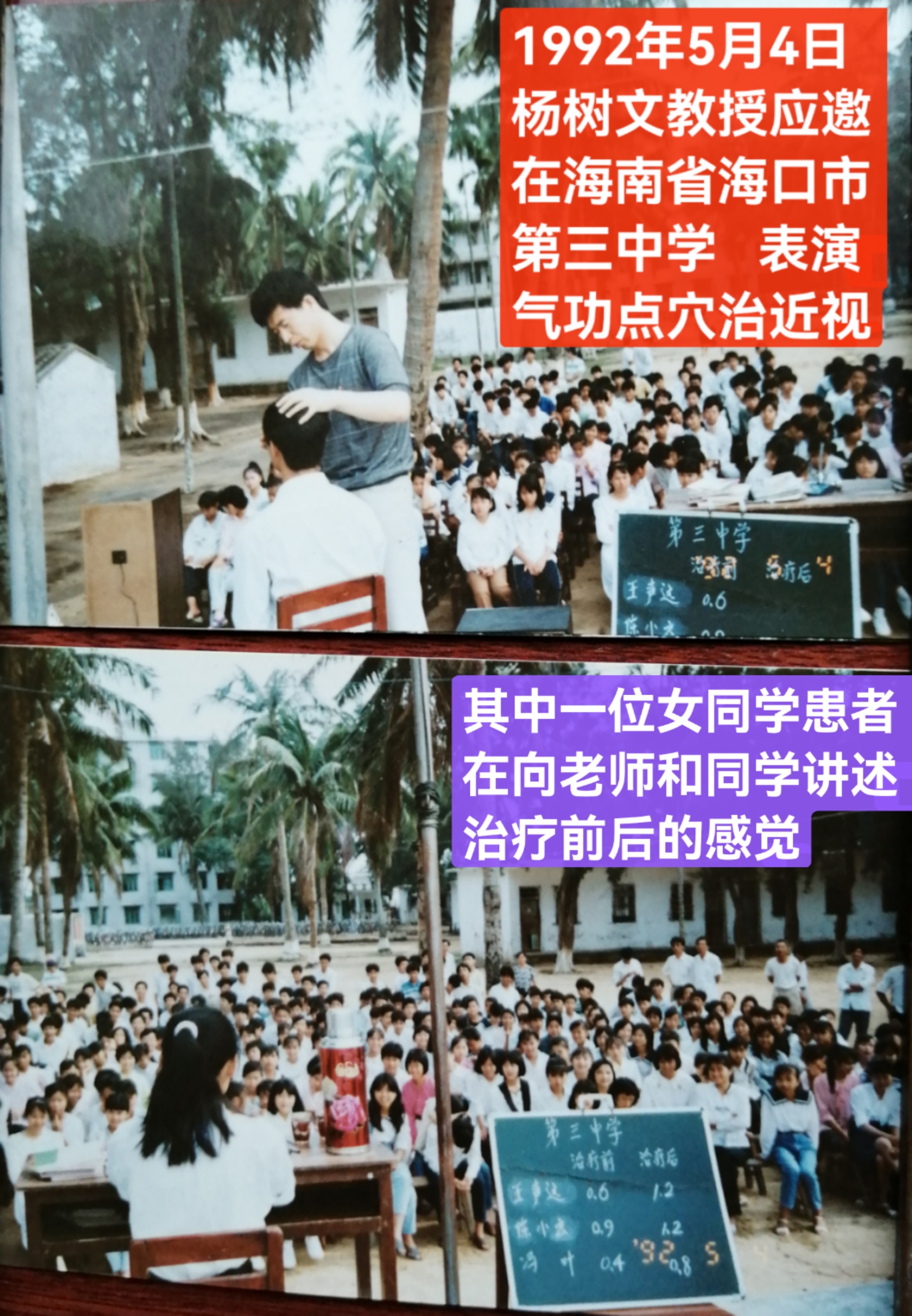 点穴治近视图片